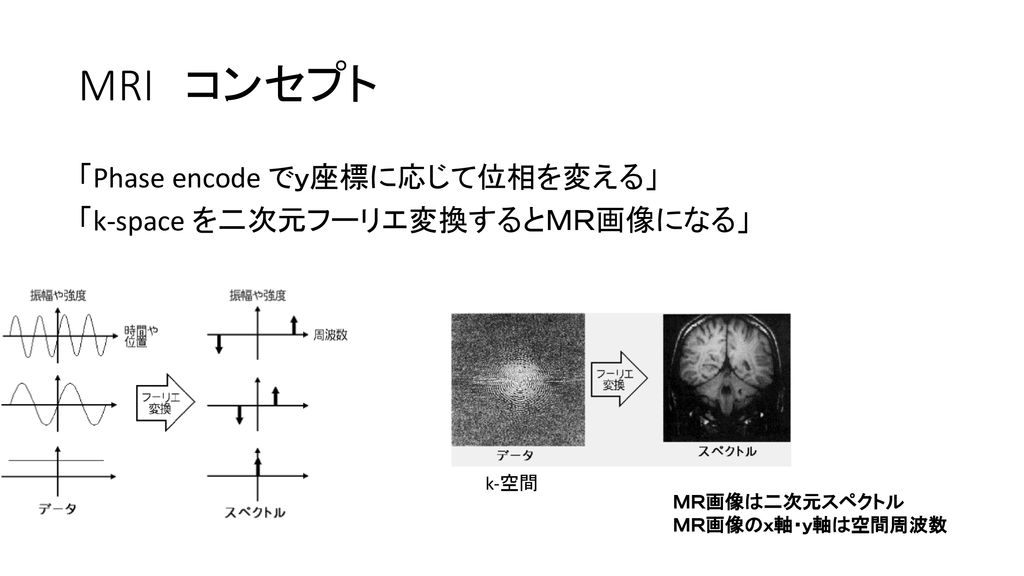 MRI検査スピード化 （疎明に映すことと併用されれば、多数の救命に